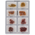Sof-Lex XT Pop-On Discs Kit #2380